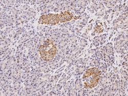 Sino Biological Anti-GPD2 Antibody, Rabbit Polyclonal, Quantity: Each of