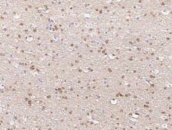 Sino Biological Anti-GPRIN1 Antibody, Rabbit Polyclonal, Quantity: Each