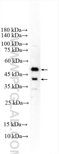 GSDMD Rabbit, anti-Human, Polyclonal, Proteintech Quantity: 20 &mu;L:Antibodies