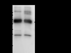 Sino Biological Anti-GSTP1/GST3 Antibody, Rabbit Polyclonal, Quantity:
