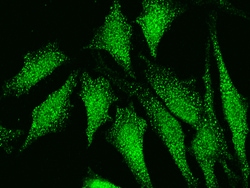 Sino Biological Anti-GSTP1/GST3 Antibody, Rabbit Polyclonal, Quantity: