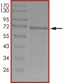 Sino Biological&nbsp;Recombinant Human HSP70 Protein (Full Length, His Tag)