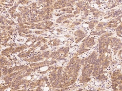 Sino Biological HAO1 Antibody, Rabbit PAb, Antigen Affinity Purified 100µL,