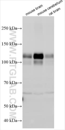 HCN2 Rabbit, anti-Human, Polyclonal, Proteintech Quantity: 150 &mu;L:Antibodies