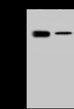 Sino Biological Human coronavirus (HCoV-OC43) Nucleocapsid Antibody, Rabbit