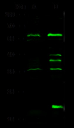Sino Biological IHPK1 Antibody, Rabbit PAb, Antigen Affinity Purified 100µL,