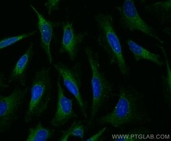 HGS Rabbit, anti-Human, CoraLite Plus 488, Polyclonal, Proteintech Quantity: