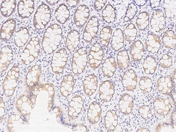 Sino Biological Anti-HIPK1 Antibody, Rabbit Polyclonal, Quantity: Each