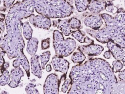 Sino Biological Anti-HMG4/HMGB3 Antibody, Rabbit Polyclonal, Quantity:
