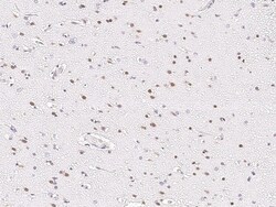 Sino Biological Anti-HOXA10 Antibody, Rabbit Polyclonal, Quantity: Each