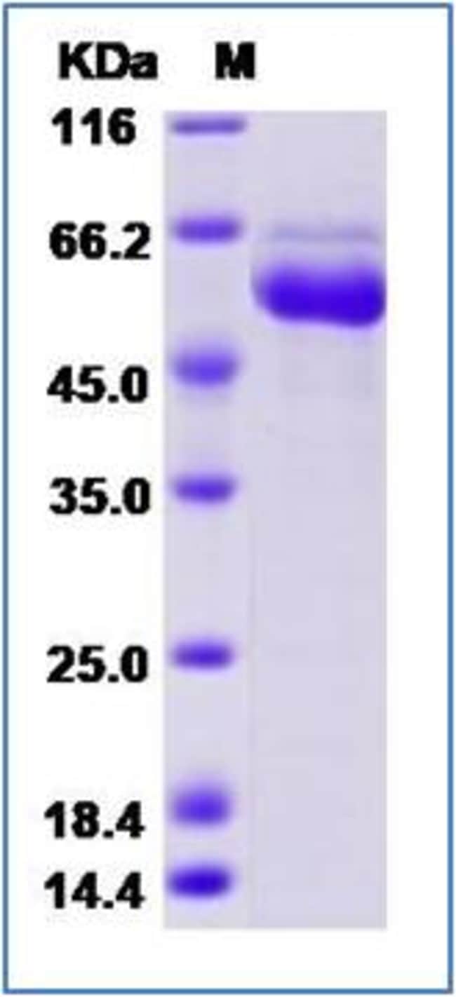 Sino Biological LAG3 Protein, Human, HPLCverified 200µg