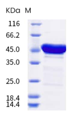 Sino Biological SARS-CoV-2 Nucleocapsid Protein (His Tag) (HPLC-verified)