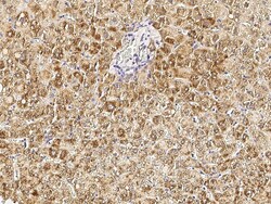 Sino Biological Anti-HSD17B4 Antibody, Rabbit Polyclonal, Quantity: Each