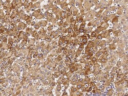 Sino Biological Anti-HSD17B6 Antibody, Rabbit Polyclonal, Quantity: Each