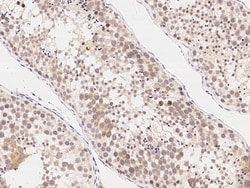Sino Biological Anti-GRP78/HSPA5 Antibody, Rabbit Polyclonal, Quantity: