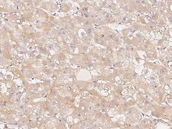 Sino Biological Anti-HTRA3 Antibody, Rabbit Polyclonal, Quantity: Each