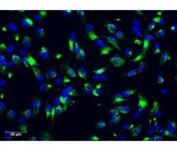 iXCells Biotechnologies Human Astrocytes (HA), Quantity: Each of 1