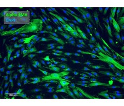 iXCells Biotechnologies Human Brain Vascular Pericytes (HBVP), Quantity: