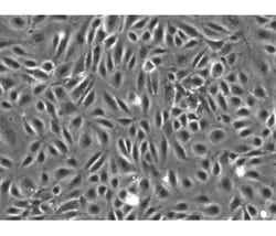 iXCells Biotechnologies Human Hepatic Sinusoidal Endothelial Cells (HHSEC,