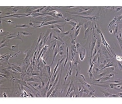 iXCells Biotechnologies Human Hepatic Stellate Cells- Adult (HHSC), Quantity: