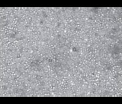 iXCells Biotechnologies Peripheral Blood Mononuclear Cells (PBMCs), 100M,