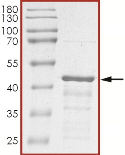 Sino Biological&nbsp;Recombinant Human IkB alpha Protein (GST Tag)