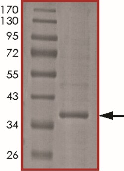Sino Biological&nbsp;Recombinant Human ING1 Protein (Full Length, His Tag)