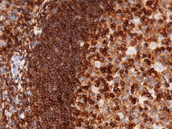 Sino Biological CD50 / ICAM-3 Antibody, Rabbit MAb 100uL, Quantity: Each