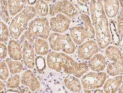 Sino Biological IGF2BP2/IMP2 Antibody, Rabbit PAb, Antigen Affinity Purified