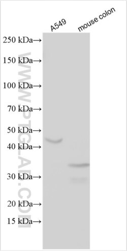 IGFBP3 Rabbit, anti-Human, Polyclonal, Proteintech:Antibodies:Primary Antibodies