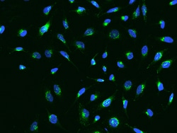 Sino Biological Human IGFBP7 MAb 100ul (Sino Biological), Quantity: Each