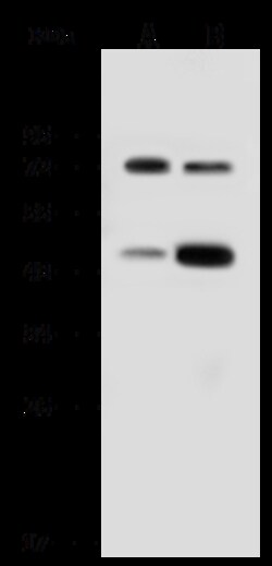 Sino Biological Recombinant Anti-IL-18R beta / IL-18RAP Antibody, Rabbit