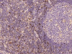 Sino Biological IL2RA/IL-2RA/CD25 Antibody, Rabbit PAb, Antigen Affinity