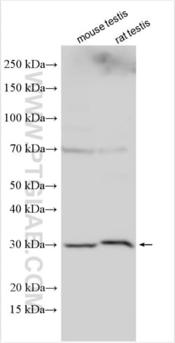 INCA1 Rabbit, anti-Human, Polyclonal, Proteintech Quantity: 150 &mu;L:Antibodies
