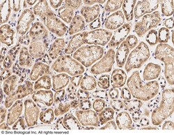 Sino Biological IRF6/IRF-6 Antibody, Rabbit PAb, Antigen Affinity Purified