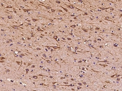 Sino Biological ITM2A Antibody, Rabbit PAb, Antigen Affinity Purified 100uL,