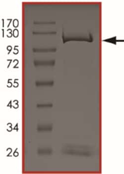 Sino Biological&nbsp;Recombinant Mouse KDM1B Protein (Full Length, GST Tag)