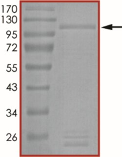 Sino Biological&nbsp;Recombinant Human KDM2A Protein (GST Tag)