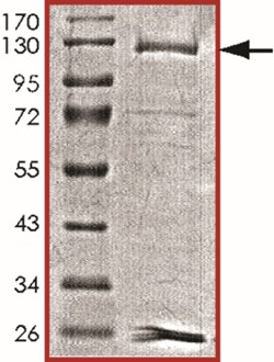 Sino Biological&nbsp;Recombinant Mouse KDM4B/JMJD2B Protein (GST Tag)