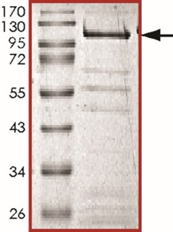 Sino Biological&nbsp;Recombinant Mouse KDM5B Protein (GST Tag)