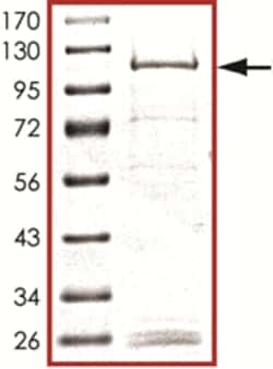 Sino Biological&nbsp;Recombinant Human KDM5C Protein (GST Tag)