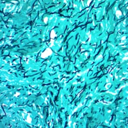 Scytek Laboratories Modified Gomori Methenamine-Silver Nitrate Stain (GMS