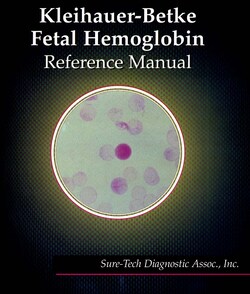 SURE TECH DIAGNOSTIC ASSOC INC KB FETAL HEMOGLOBIN MANUAL, Quantity: Each
