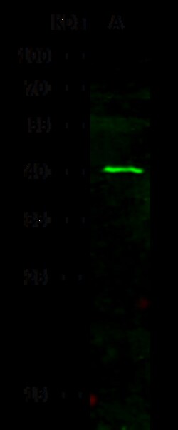 Sino Biological Ebola virus EBOV (subtype Zaire, strain H.sapiens-wt/GIN/2014/Kissidougou-C15)