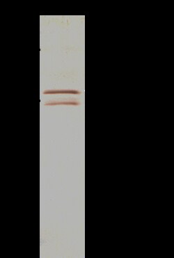 Sino Biological Anti-MYOD1 Antibody, Rabbit Polyclonal, Quantity: Each
