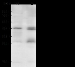 Sino Biological Anti-JAM-2/JAM-B Antibody, Rabbit Polyclonal, Quantity: