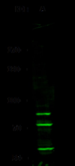 Sino Biological Anti-Integrin beta 3 Antibody, Rabbit Polyclonal, Quantity: