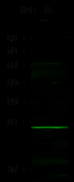 Sino Biological PDGF-B/PDGF-2 Antibody, Rabbit PAb, Antigen Affinity Purified
