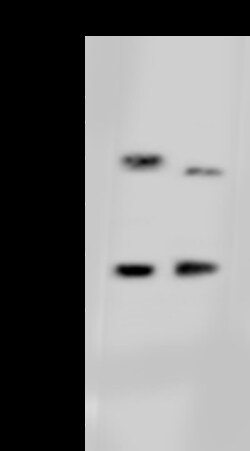 Sino Biological Anti-DHRS3 Antibody, Rabbit Polyclonal, Quantity: Each