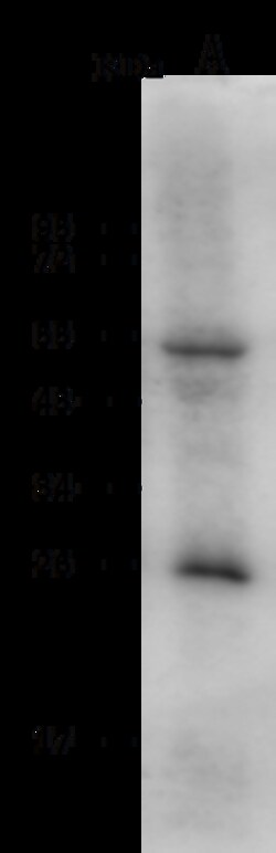 Sino Biological Anti-LRRC17 Antibody, Rabbit Polyclonal, Quantity: Each